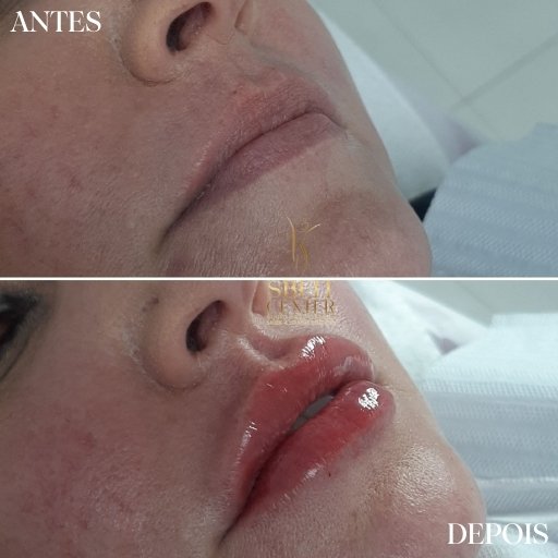 Labios (10)