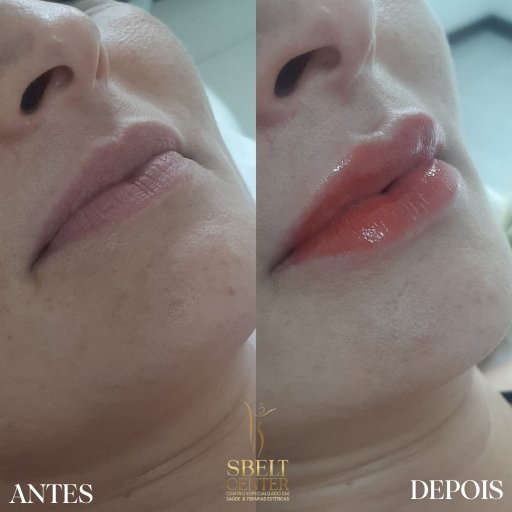 Labios (11)
