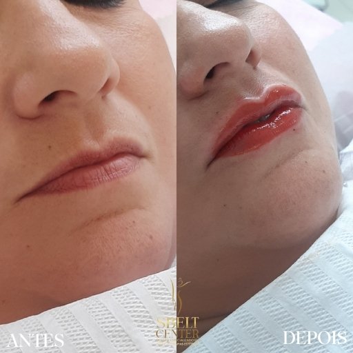 Labios (12)