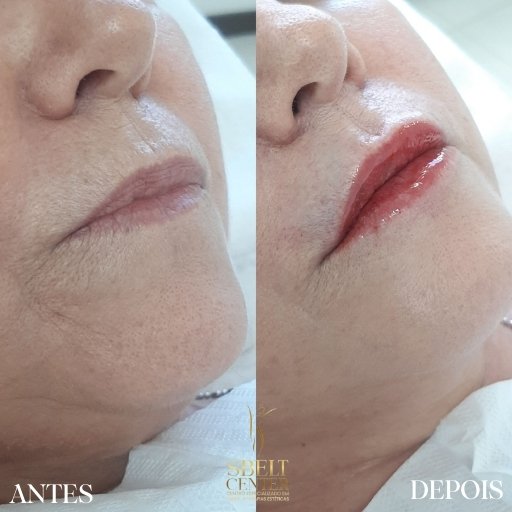 Labios (13)