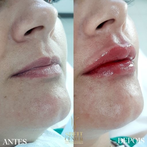 Labios (14)