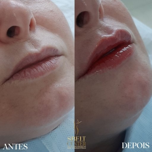 Labios (15)