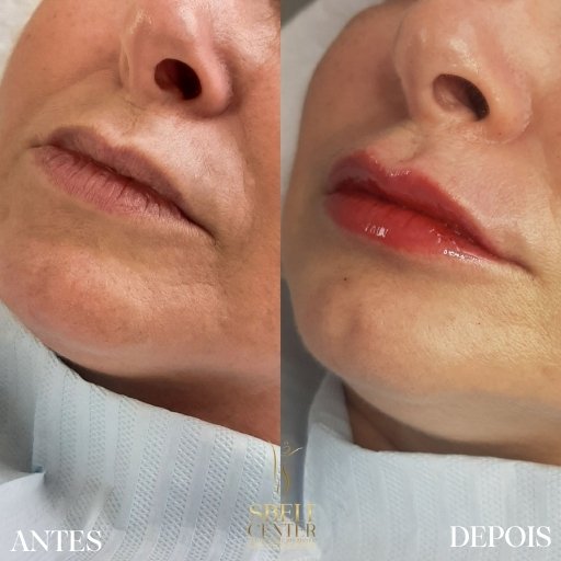 Labios (16)
