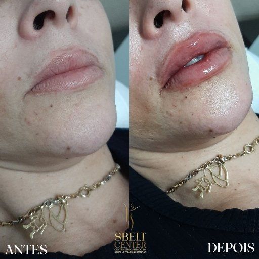 Labios (17)