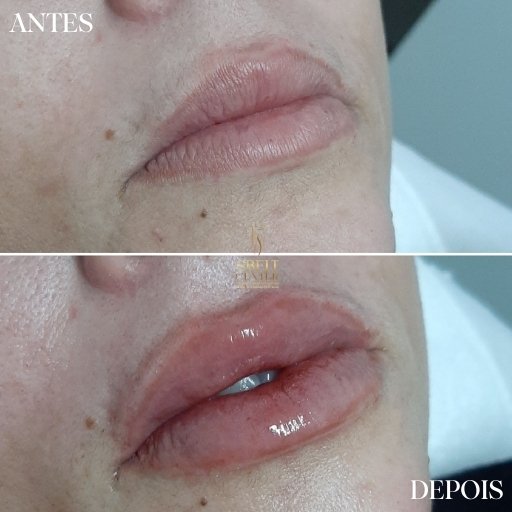 Labios (18)