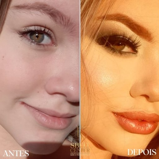 Labios (2)