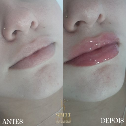 Labios (20)