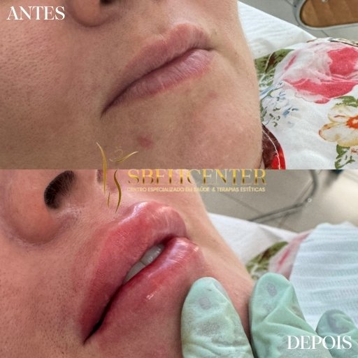 Labios (3)