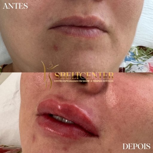 Labios (4)