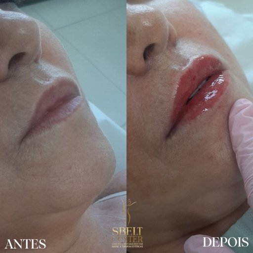 Labios (5)