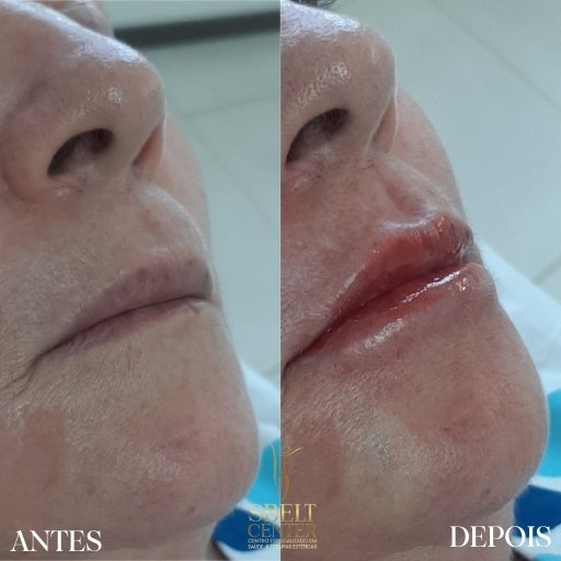 Labios (6)