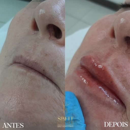 Labios (7)