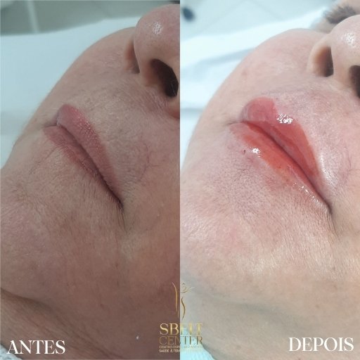 Labios (9)